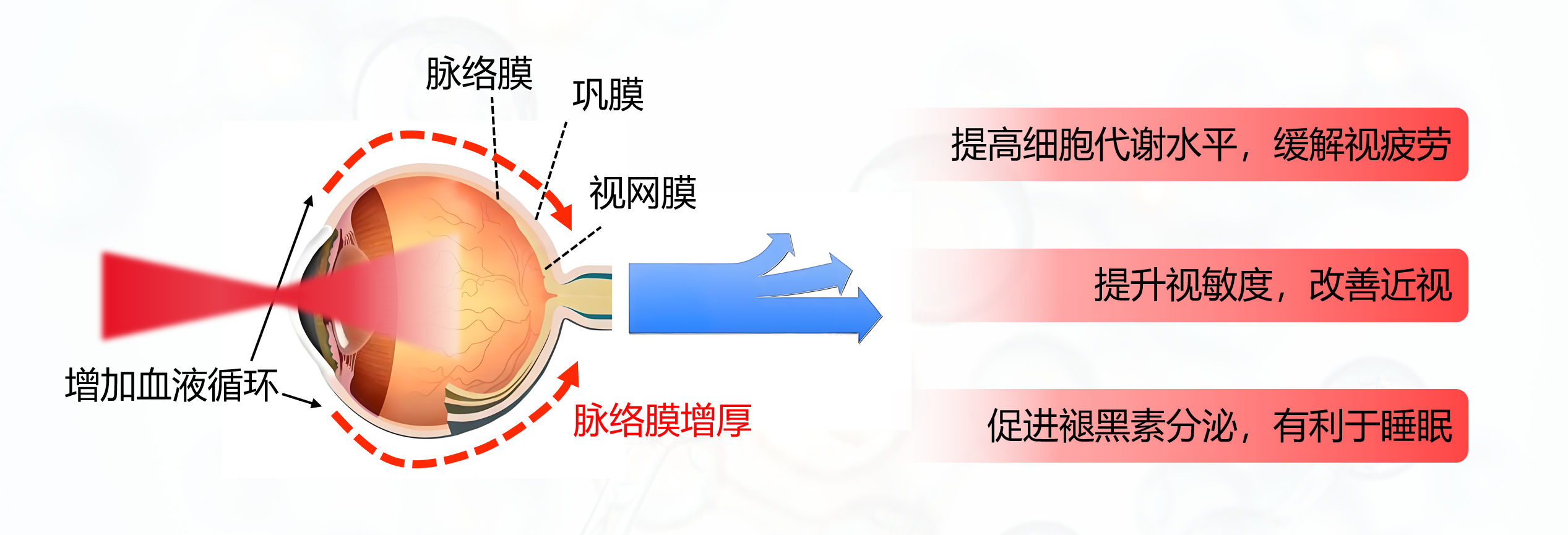 红光作用于眼底的示意图